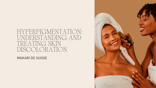 Hyperpigmentation: Understanding and Treating Skin Discoloration