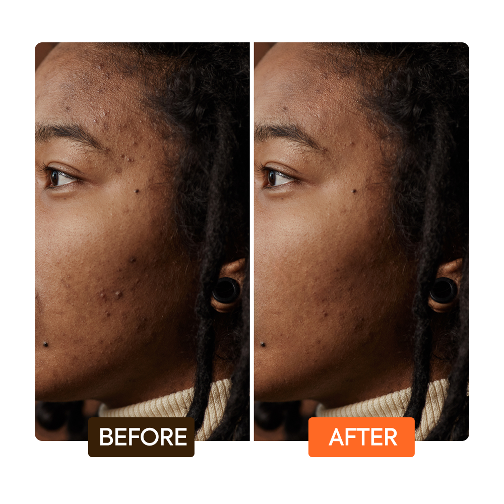 Extreme Argan & Carrot Oil Dark Spot Corrector Serum - Image 8