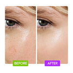 20% Aha + 10% Niacinamide Booster - IYKYK - Image 6