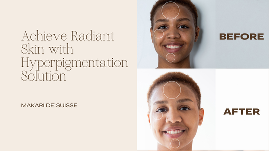 Achieve Radiant, Even Skin with the Exclusive Dark Spot Corrector Serum