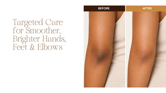 Makari Clarifying Cream for Hands, Feet & Elbows