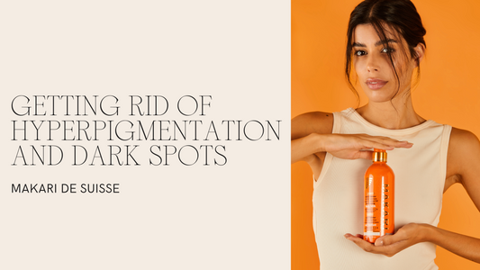 Getting Rid of Hyperpigmentation and Dark Spots