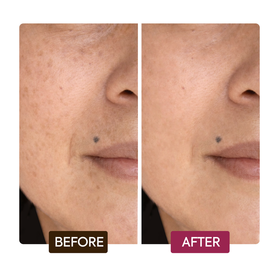 Makari Day Radiance Face Cream before and after