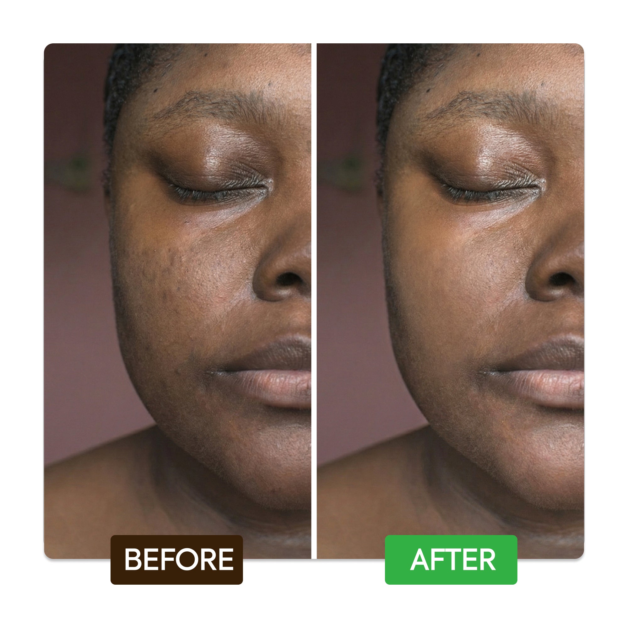 Kojic & Azelaic Brightening Serum – Makari Shop