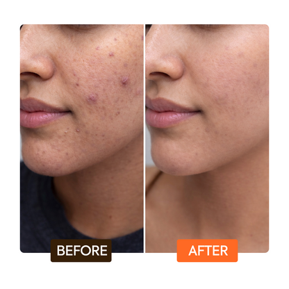 Naturalle Carotonic Extreme Glow Renewing Face Serum - Image 6