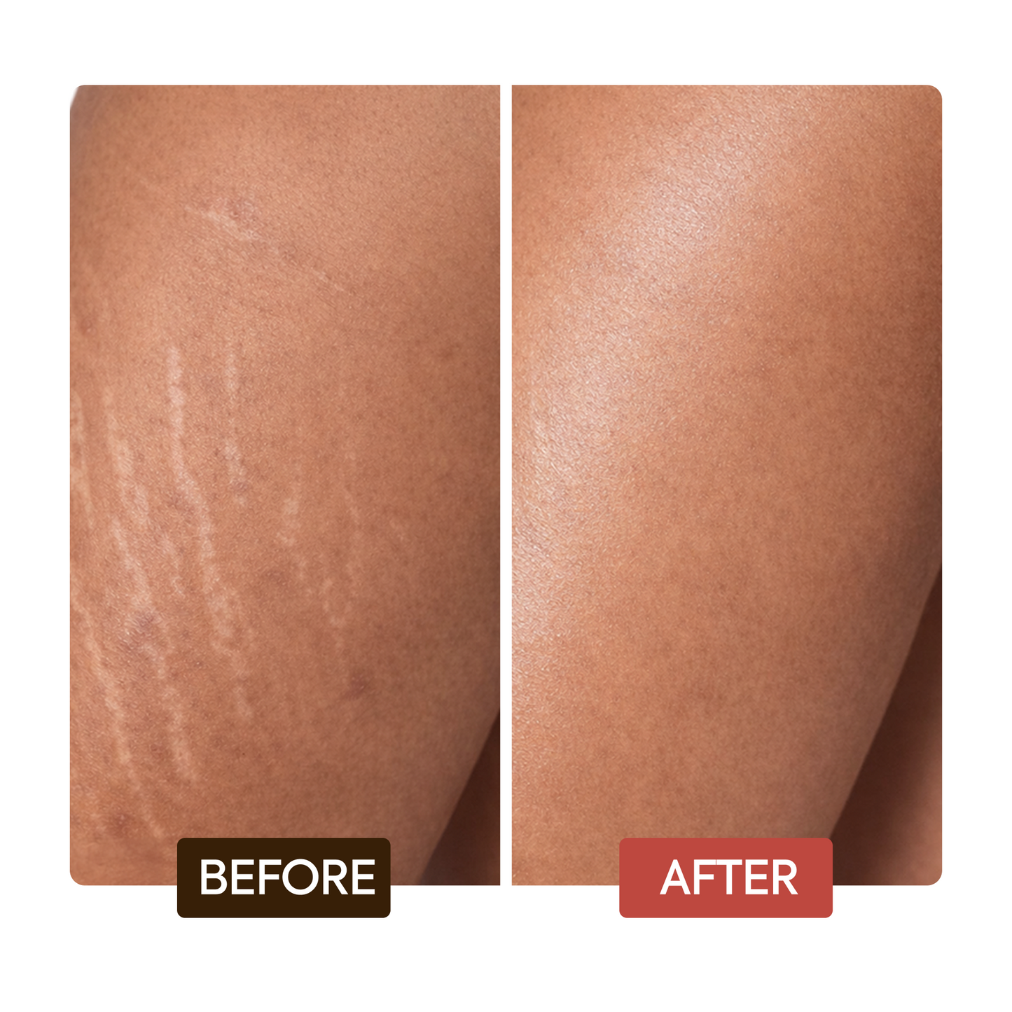 Naturalle Intense Extreme Glow Rejuvenating Body Lotion - Image 6