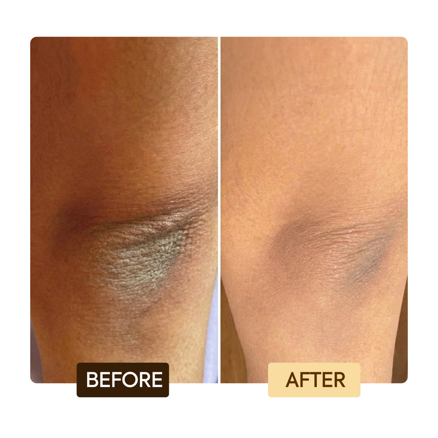 Makari Exclusive Tone Boosting Body Milk before and after