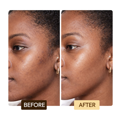 Exclusive Dark Spot Corrector Serum - Image 6