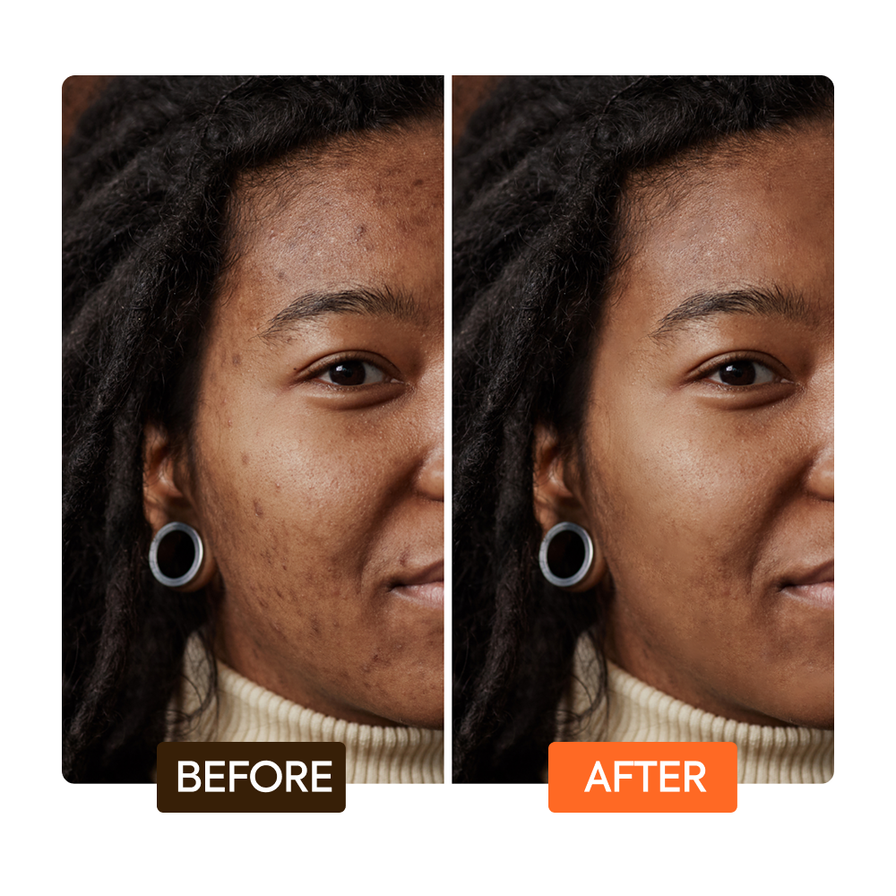 Extreme Argan & Carrot Oil Multi Function Soap - Image 7