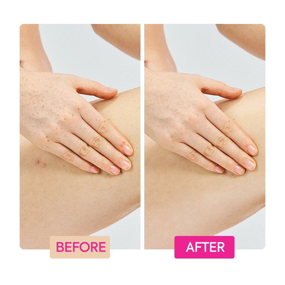 Ginger Extract + Tranexamic Acid + Retinol Body Toning Cream - IYKYK - Image 6