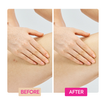 Ginger Extract + Tranexamic Acid + Retinol Body Toning Cream - IYKYK - Image 6