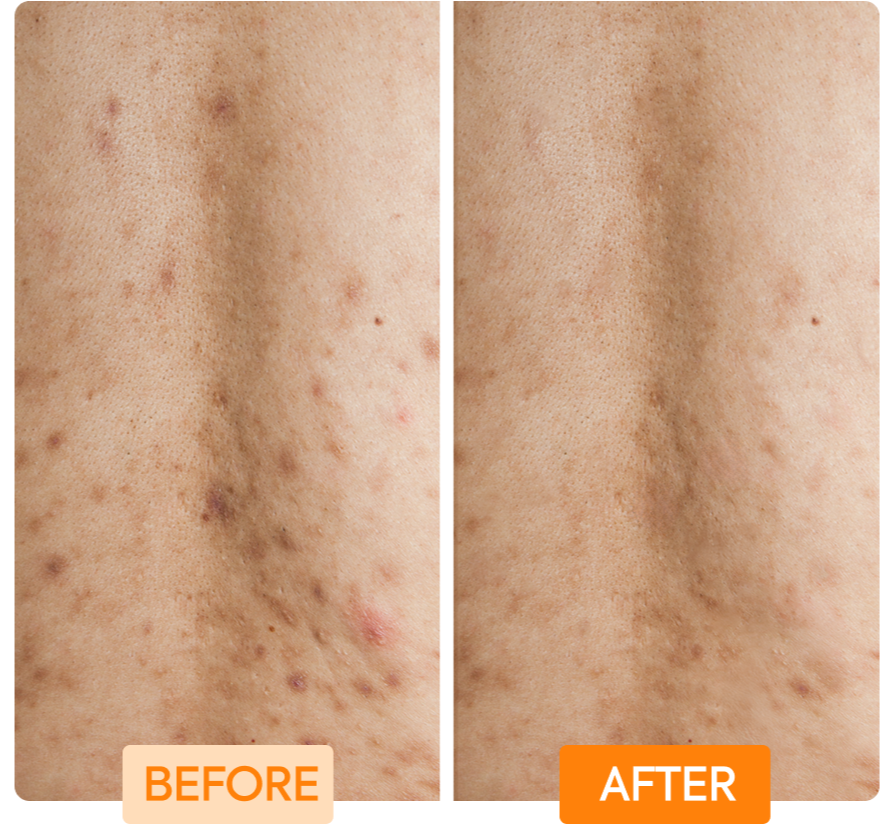 IYKYK GLYCOLIC + LACTIC ACID + NIANCINIMIDE BODY WASH - 2 PACK - Image 6